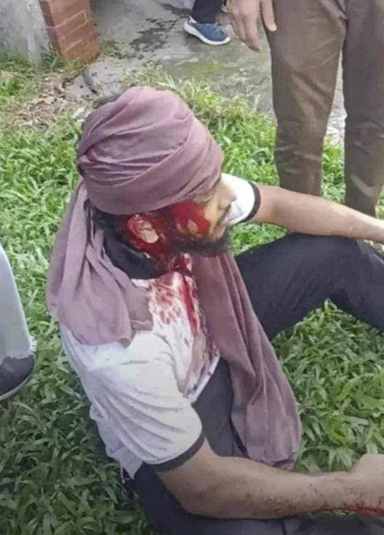 রক্তাক্ত ঢাবি, চবি, জাবি। রক্তাক্ত বাংলাদেশ।