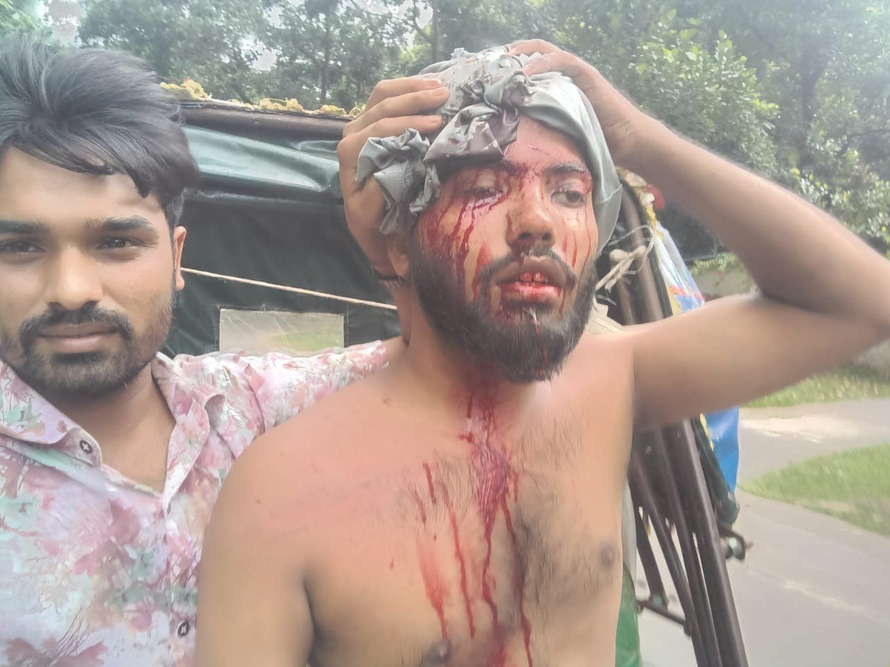 চবিতে শহীদ মিনার এলাকায় ছাত্রলীগের হামলা... অনেকে আহত