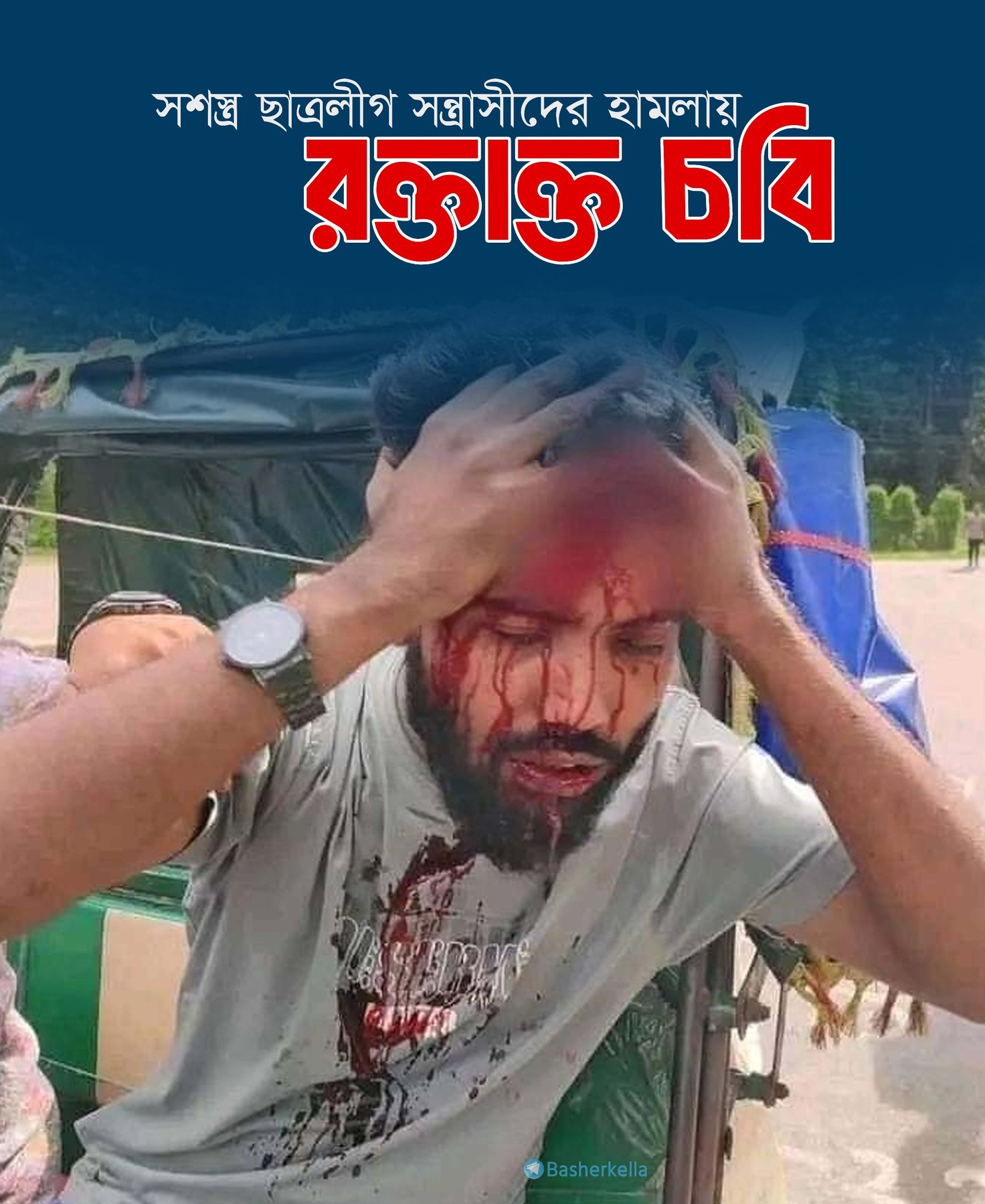 সশস্ত্র ছাত্রলীগ সন্ত্রাসীদের হামলায় রক্তাক্ত চবি। গুরুতর আহত অসংখ্য শিক্ষার্থী।