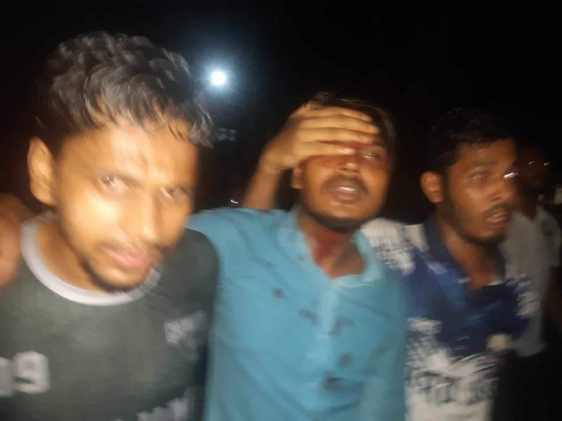 শাবিতে ছাত্রলীগের হামলায় সাধারন শিক্ষার্থী