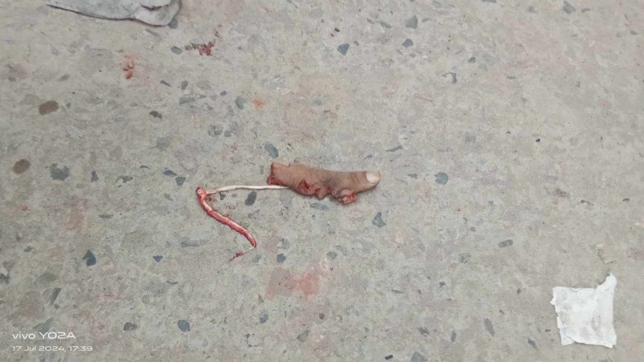 ঢাবিতে 😢