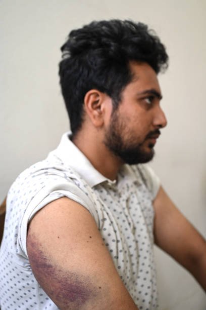 BANGLADESH-UNREST-STUDENTS-ARREST