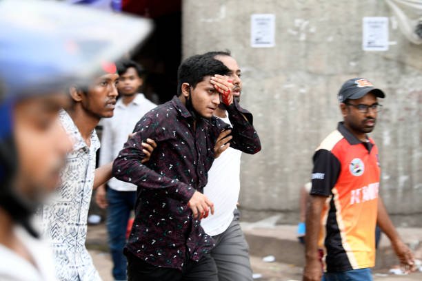 A student seen injured following clashes between anti-quota