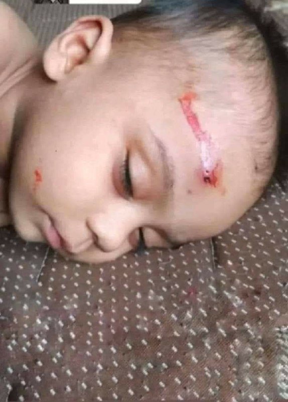 আপনার নিজের ছোট্ট সন্তানকে এই সোনামণির জায়গায় ১ মিনিটের জন্য ভাবতে পারবেন?
