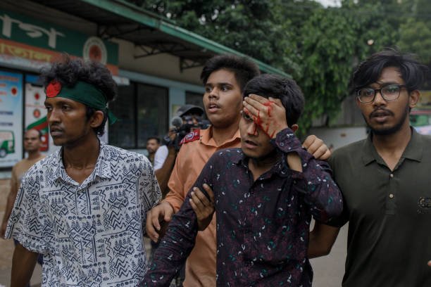 A student injured during a clash between anti-quota