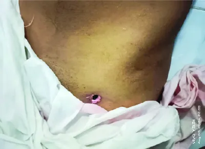 মোঃ ফজলু