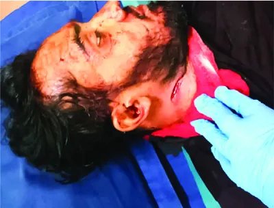 মো: বিপ্লব মণ্ডল